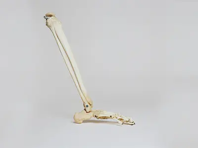 Indywidualnie dopasowane implanty z drukarki 3D