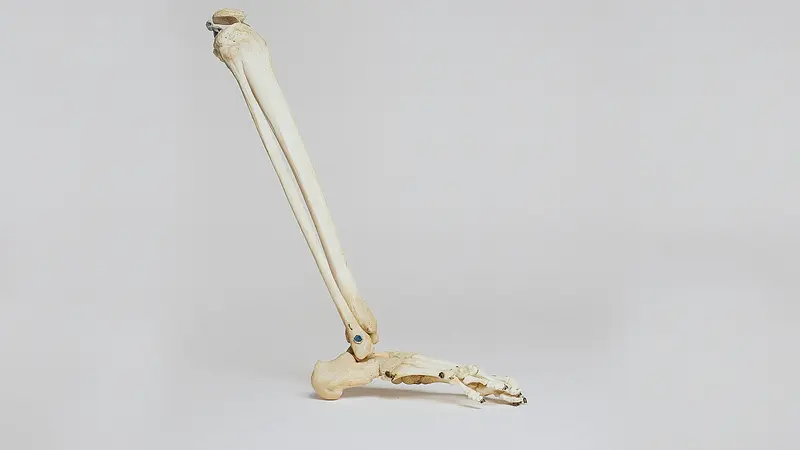 Indywidualnie dopasowane implanty z drukarki 3D