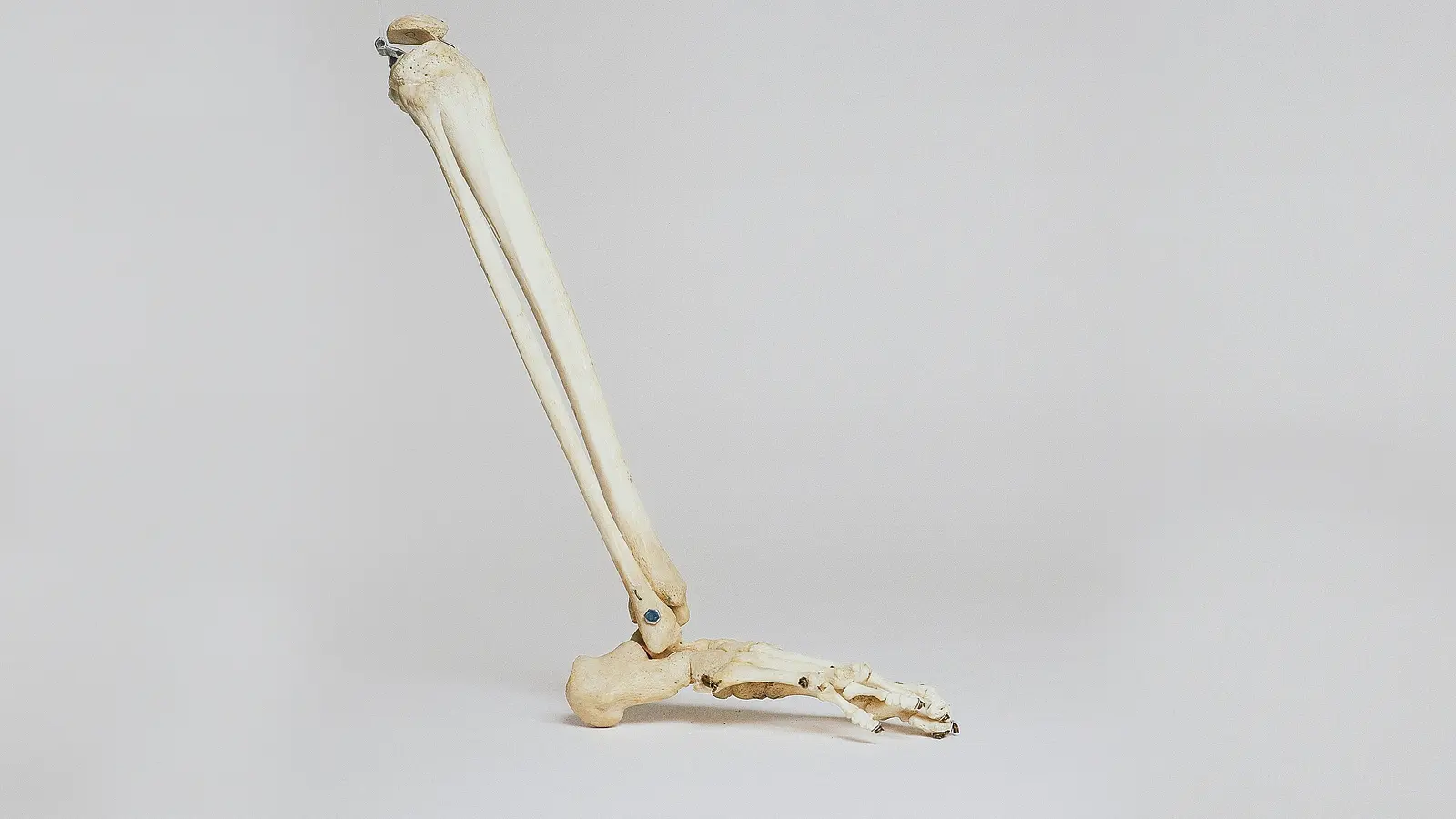 Indywidualnie dopasowane implanty z drukarki 3D